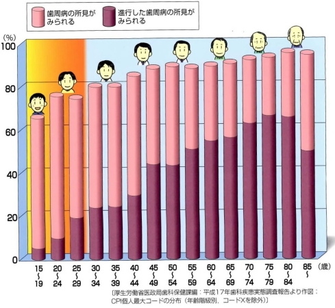 日本の１５～１９才の６５％、２０代で７５％以上、３０代で８０％が歯周病にかかっています