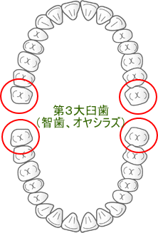 親知らず 　桜新町　歯科