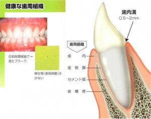 健康な歯周組織