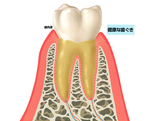 健康な歯周組織