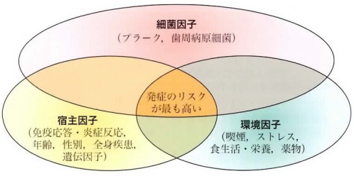 歯周病の発症と進行における細菌因子・宿主因子・環境因子