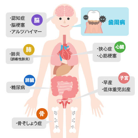 歯周病とからだの病気