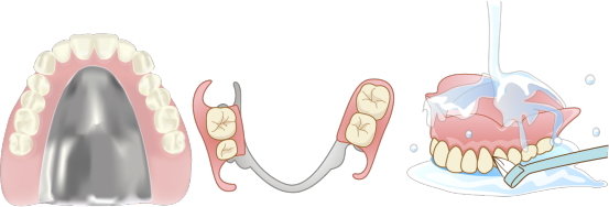 入れ歯の種類