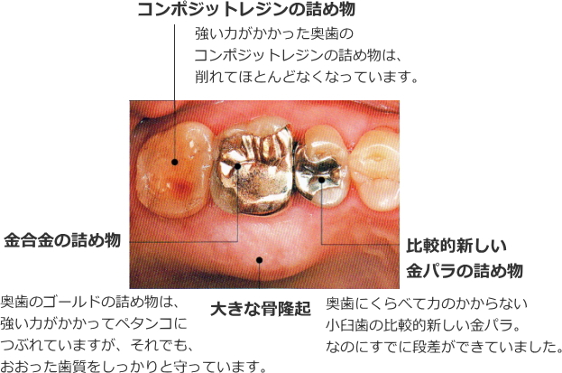 金パラ　金合金